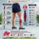 Best DVT (Deep Vein Thrombosis) Treatment in Kolkata | Expert Vascular Care
